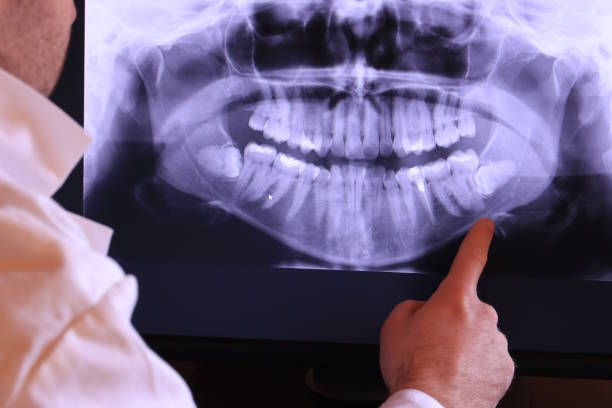 Best Emergency Dental Care for Trauma or Injury in Franconia, VA
