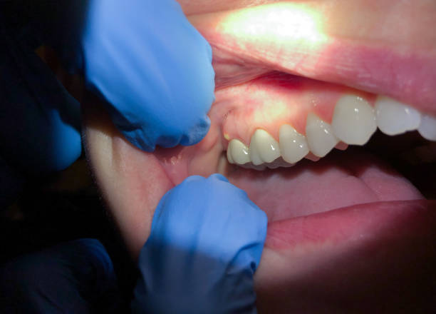 Best Weekend Emergency Dentist in Franconia, VA
