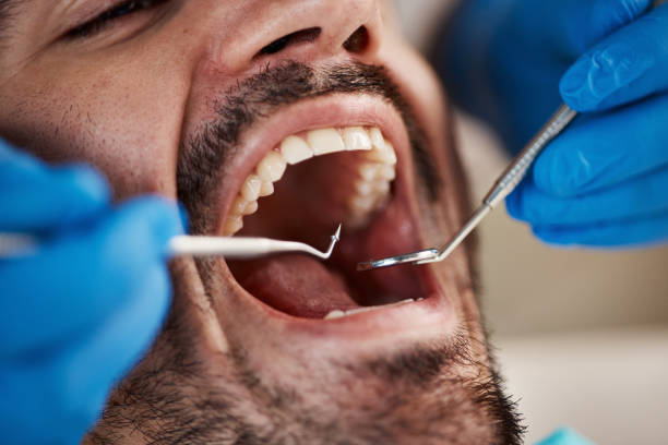 Best Pediatric Emergency Dentist in Franconia, VA